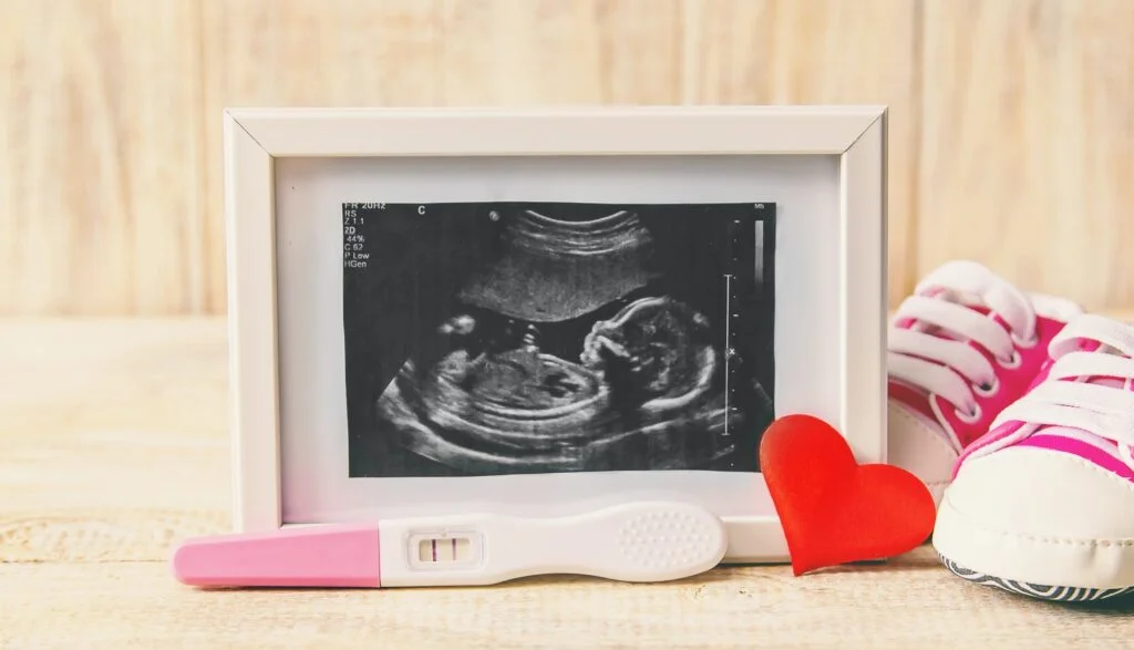 Ultrasound picture of a baby's photograph and accessories. Selective focus.